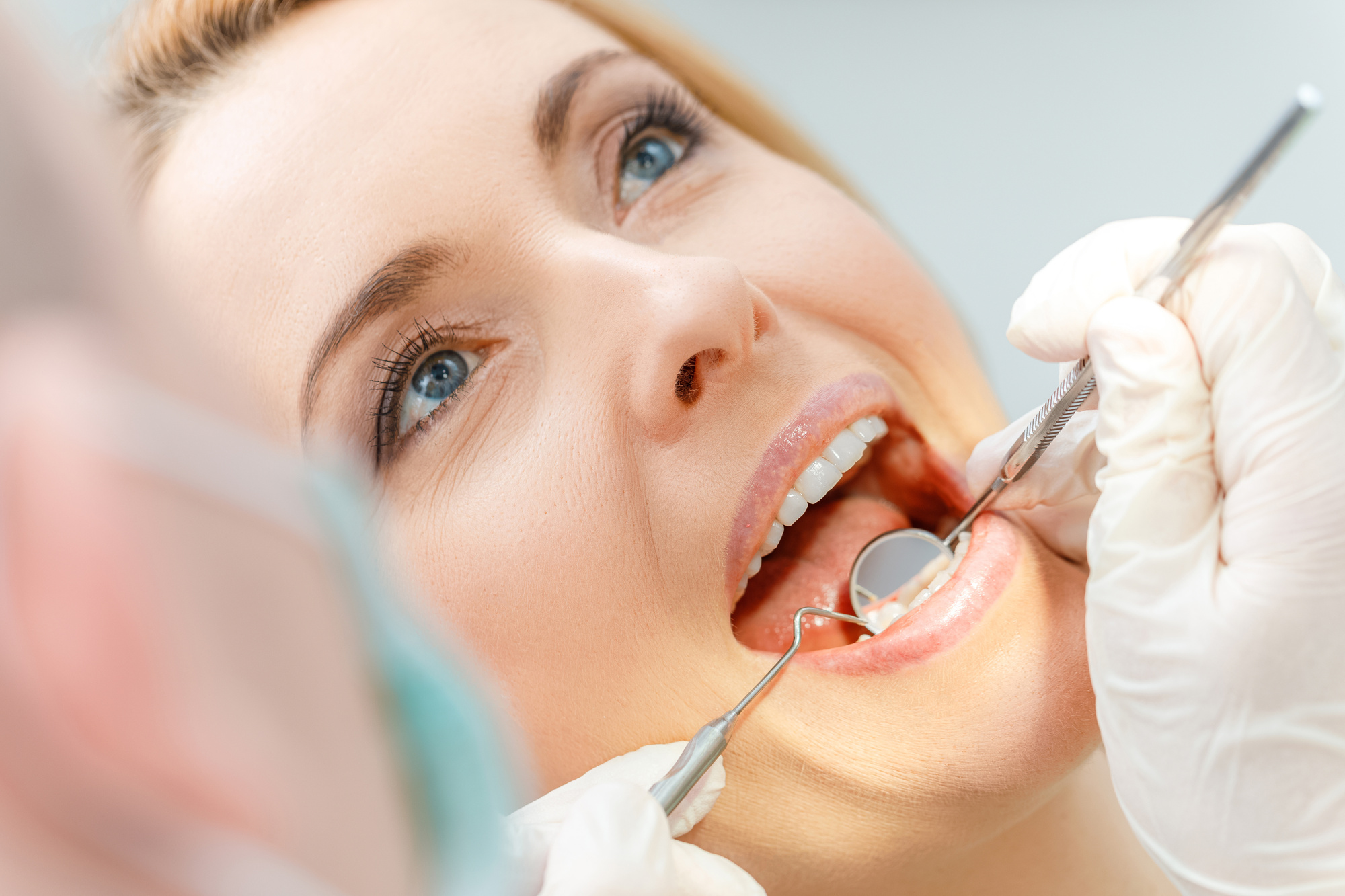 Close-up partial view of beautiful middle aged woman at dental check up