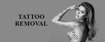 Tattoo Removal (Icon Photo)